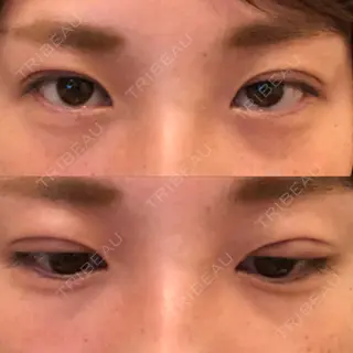 1日目の経過画像（1枚目）