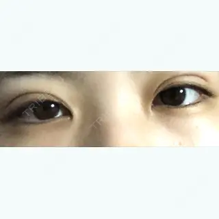 10日目の経過画像（1枚目）