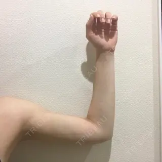 20日目の経過画像（2枚目）