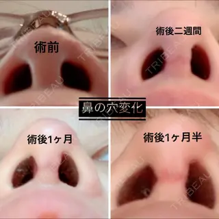 47日目の経過画像（1枚目）