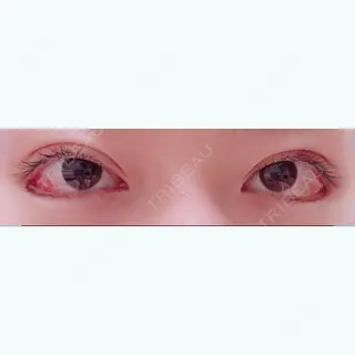 18日目の経過画像（1枚目）