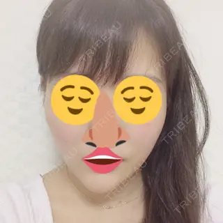 41日目の経過画像（1枚目）