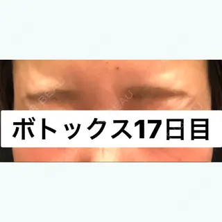 17日目の経過画像（1枚目）