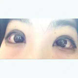 31日目の経過画像（1枚目）