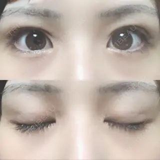 7日目の経過画像（1枚目）