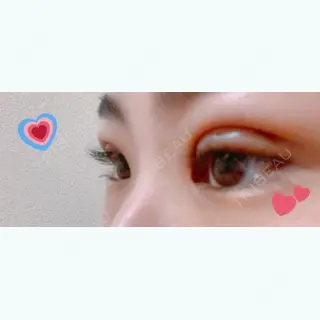 1日目の経過画像（2枚目）