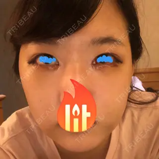 8日目の経過画像（1枚目）