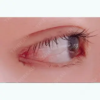 21日目の経過画像（3枚目）