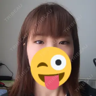 4日目の経過画像（1枚目）