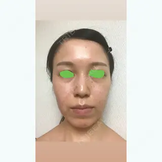 1日目の経過画像（1枚目）