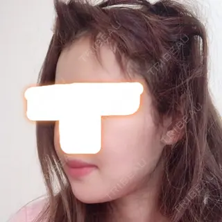 1日目の経過画像（2枚目）