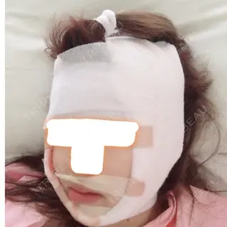 0日目の経過画像（2枚目）