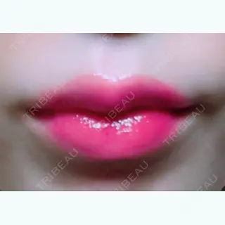 29日目の経過画像（3枚目）