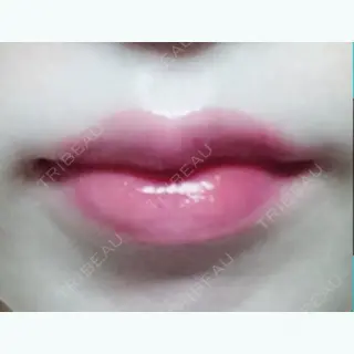 31日目の経過画像（1枚目）