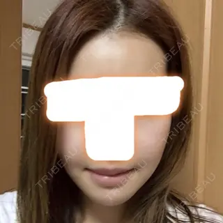 9日目の経過画像（1枚目）