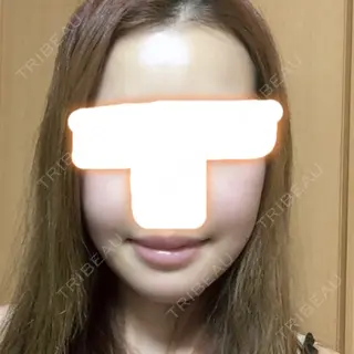12日目の経過画像（1枚目）