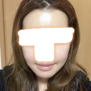 13日目の経過画像（1枚目）