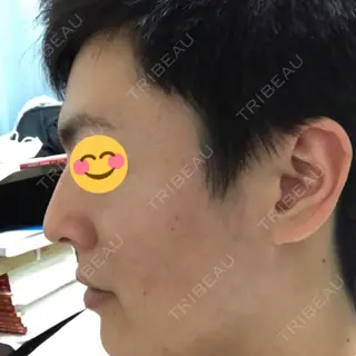 128日目の経過画像（3枚目）
