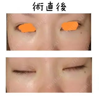 0日目の経過画像（1枚目）