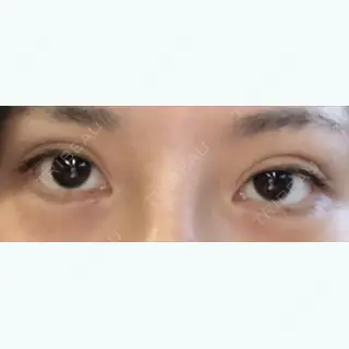 459日目の経過画像（1枚目）