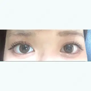 7日目の経過画像（1枚目）
