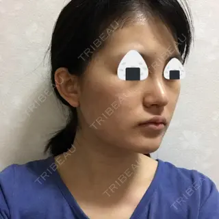 8日目の経過画像（2枚目）