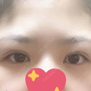 1日目の経過画像（1枚目）