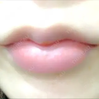 1日目の経過画像（1枚目）
