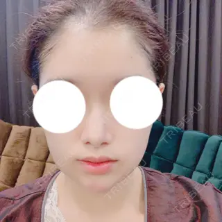 0日目の経過画像（1枚目）
