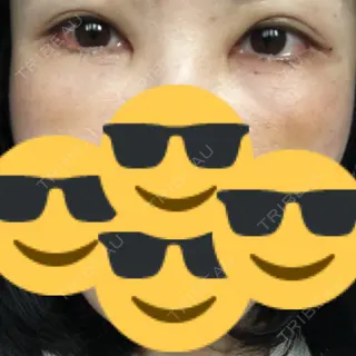 3日目の経過画像（1枚目）