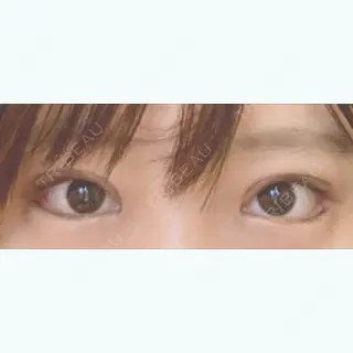 19日目の経過画像（1枚目）