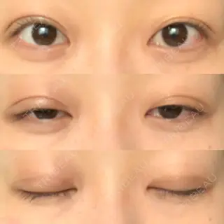 9日目の経過画像（1枚目）