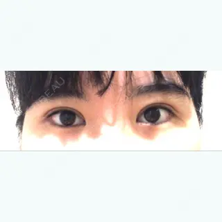 38日目の経過画像（1枚目）