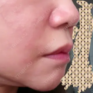0日目の経過画像（3枚目）
