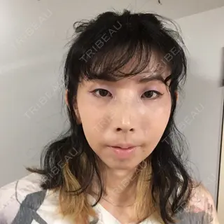 9日目の経過画像（3枚目）