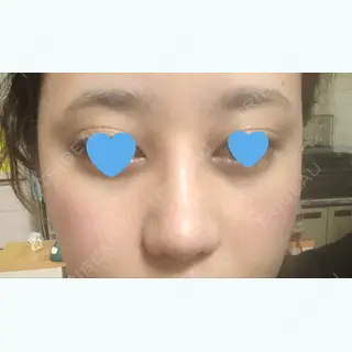 8日目の経過画像（3枚目）