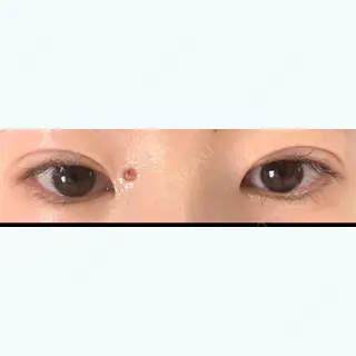 48日目の経過画像（2枚目）
