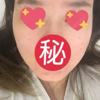 9日目の経過画像（1枚目）