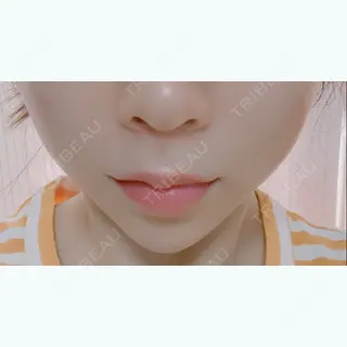 12日目の経過画像（1枚目）