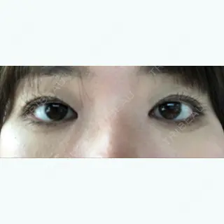 19日目の経過画像（1枚目）