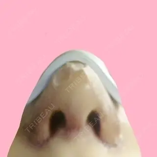 4日目の経過画像（1枚目）