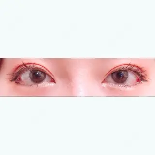 30日目の経過画像（1枚目）