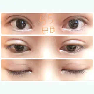 55日目の経過画像（1枚目）