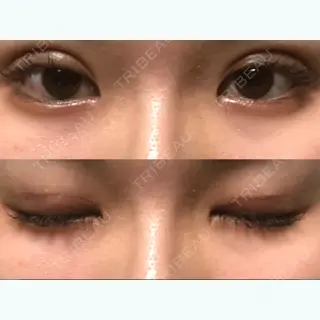 8日目の経過画像（1枚目）