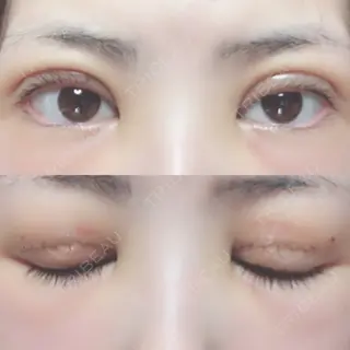 3日目の経過画像（1枚目）