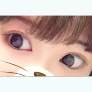 10日目の経過画像（1枚目）
