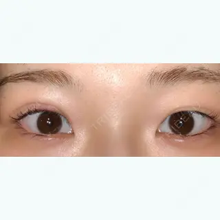 790日目の経過画像（2枚目）