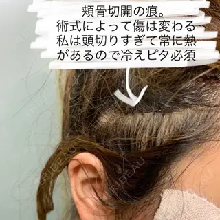 3日目の経過画像（2枚目）