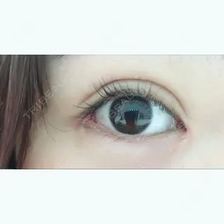 31日目の経過画像（1枚目）