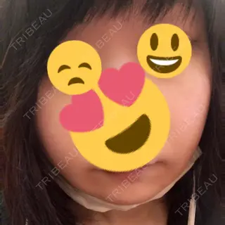 8日目の経過画像（1枚目）